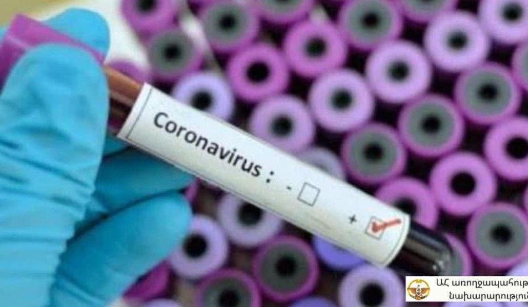 Արցախում երեկ հայտնաբերվել է կորոնավիրուսի 9 նոր դեպք՝ 93 թեստավորումից