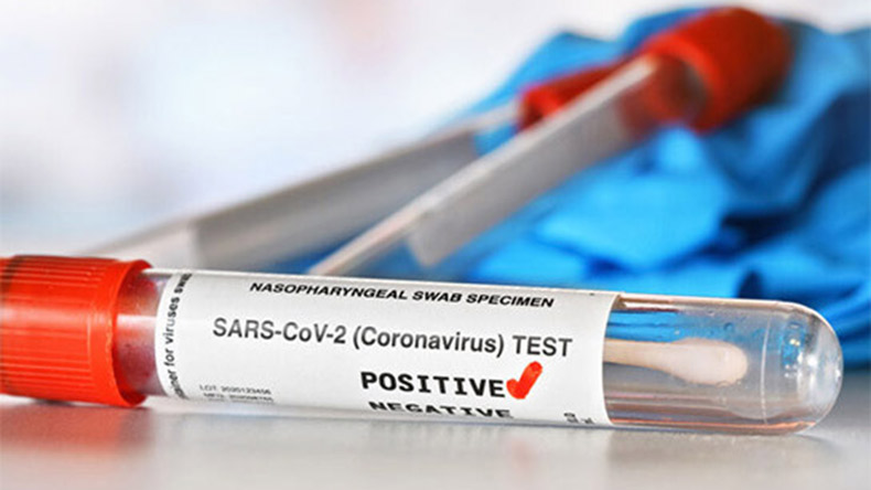 Արցախում երեկ հաստատվել է կորոնավիրուսի 5 նոր դեպք՝ 87 թեստավորումից